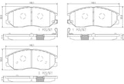 Brembo Premium Low-Met OE Equivalent Pad Brake Pad P30078N - Disc Set
